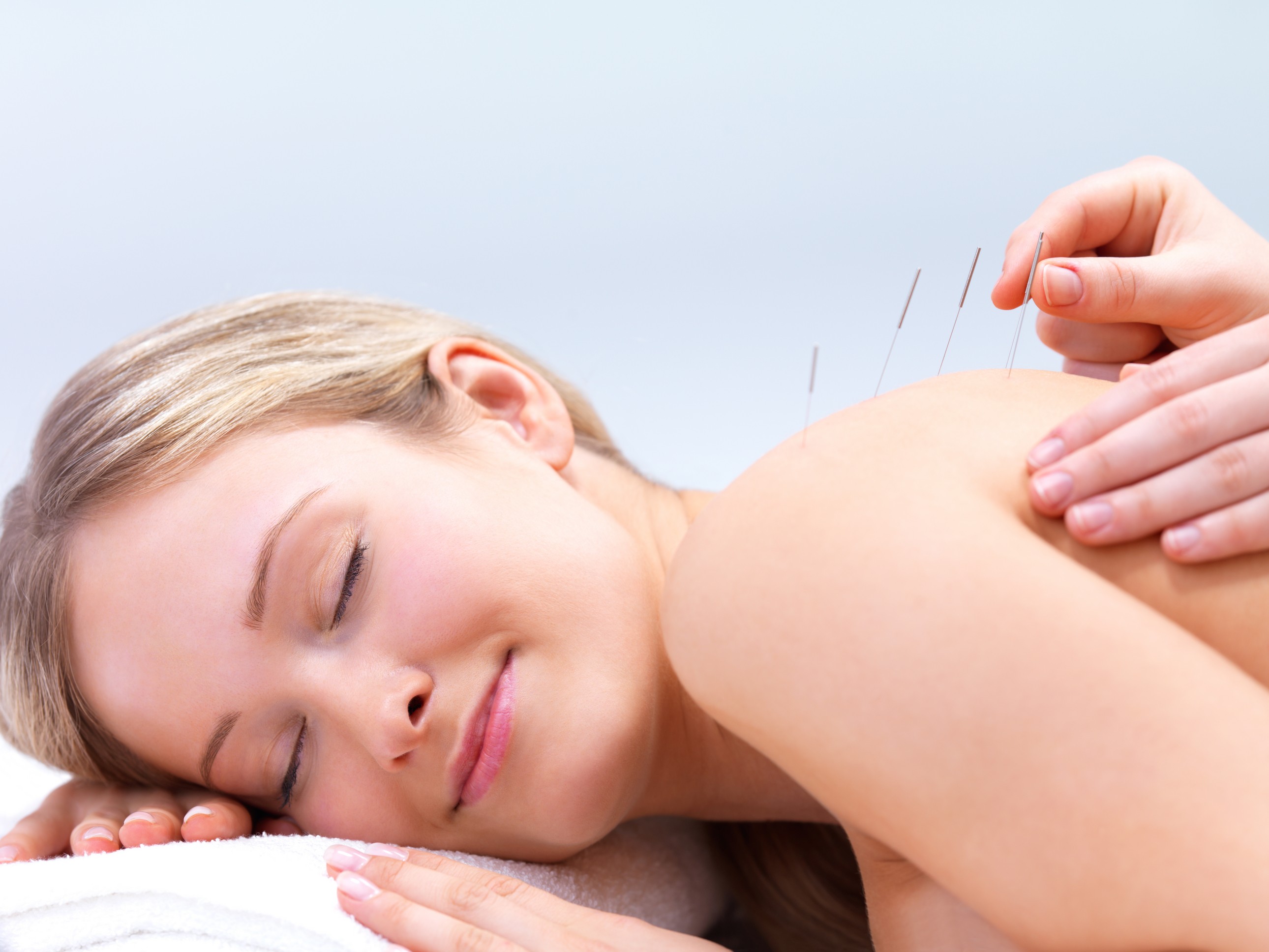 Acupuncture service at Womens Health Physiotherapy, Warrington